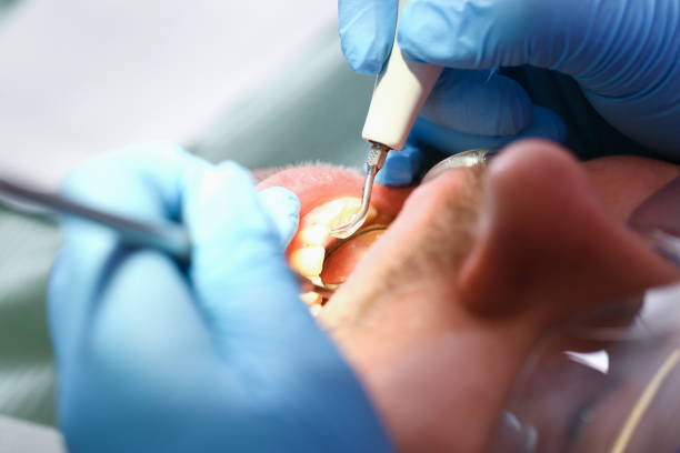 Best Chipped Tooth Repair Near Me  in Peridot, AZ